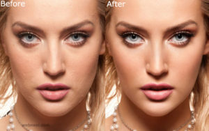 26-skin-photo-retouching-after-before.preview